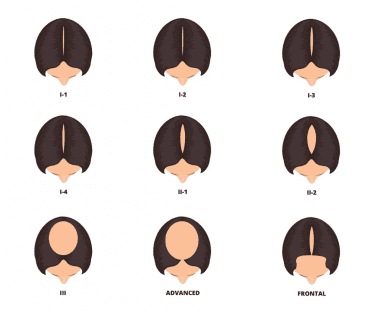 ludwig-scale