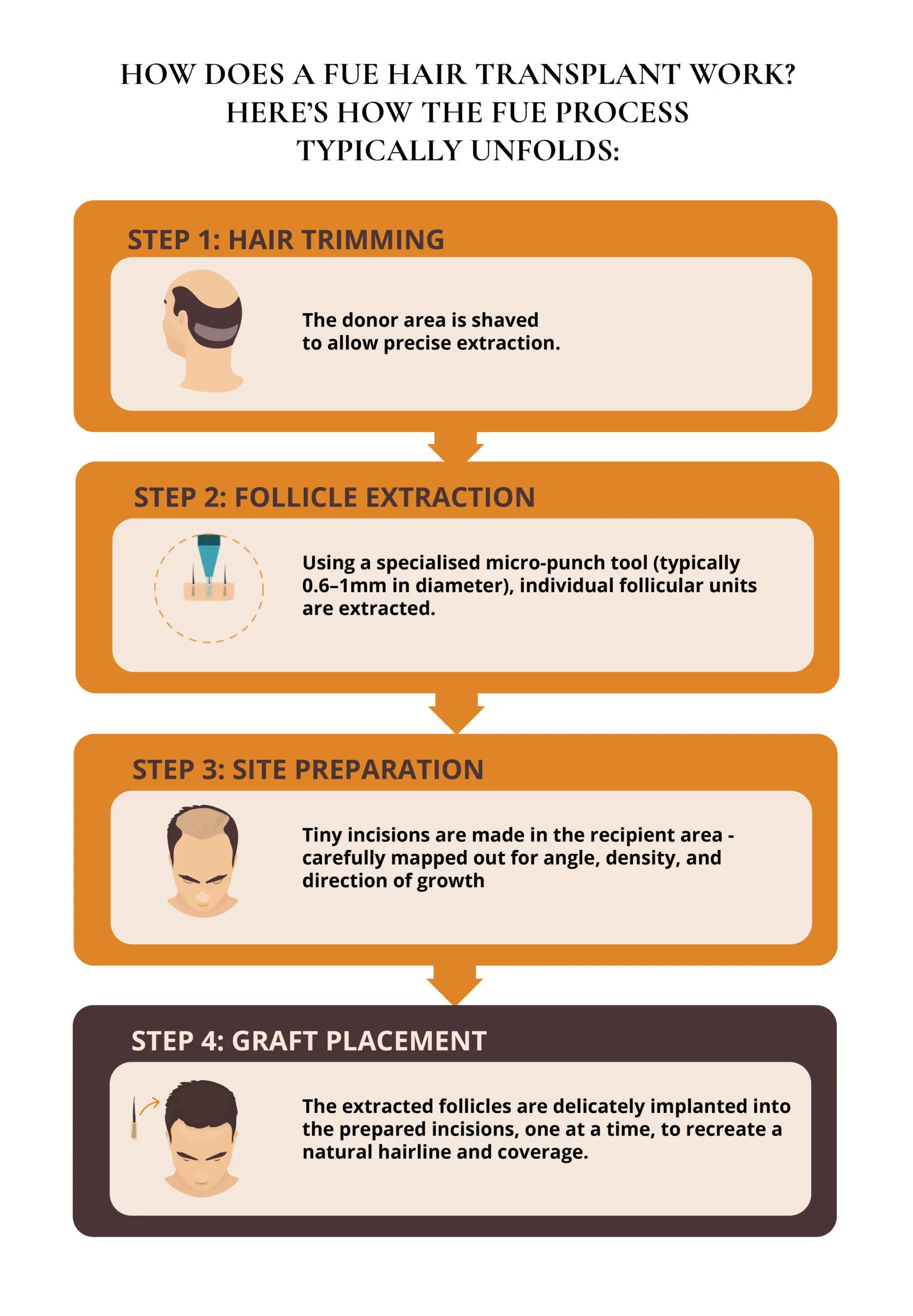 An informative infographic from Capital Hair Restoration explaining the typical Follicular Unit Extraction (FUE) hair transplant process. The guide breaks down the four key steps: hair trimming of the donor area for precise extraction, follicle extraction using a micro-punch tool, site preparation with tiny incisions carefully mapped for natural growth, and graft placement where extracted follicles are delicately implanted to recreate a natural hairline and coverage.