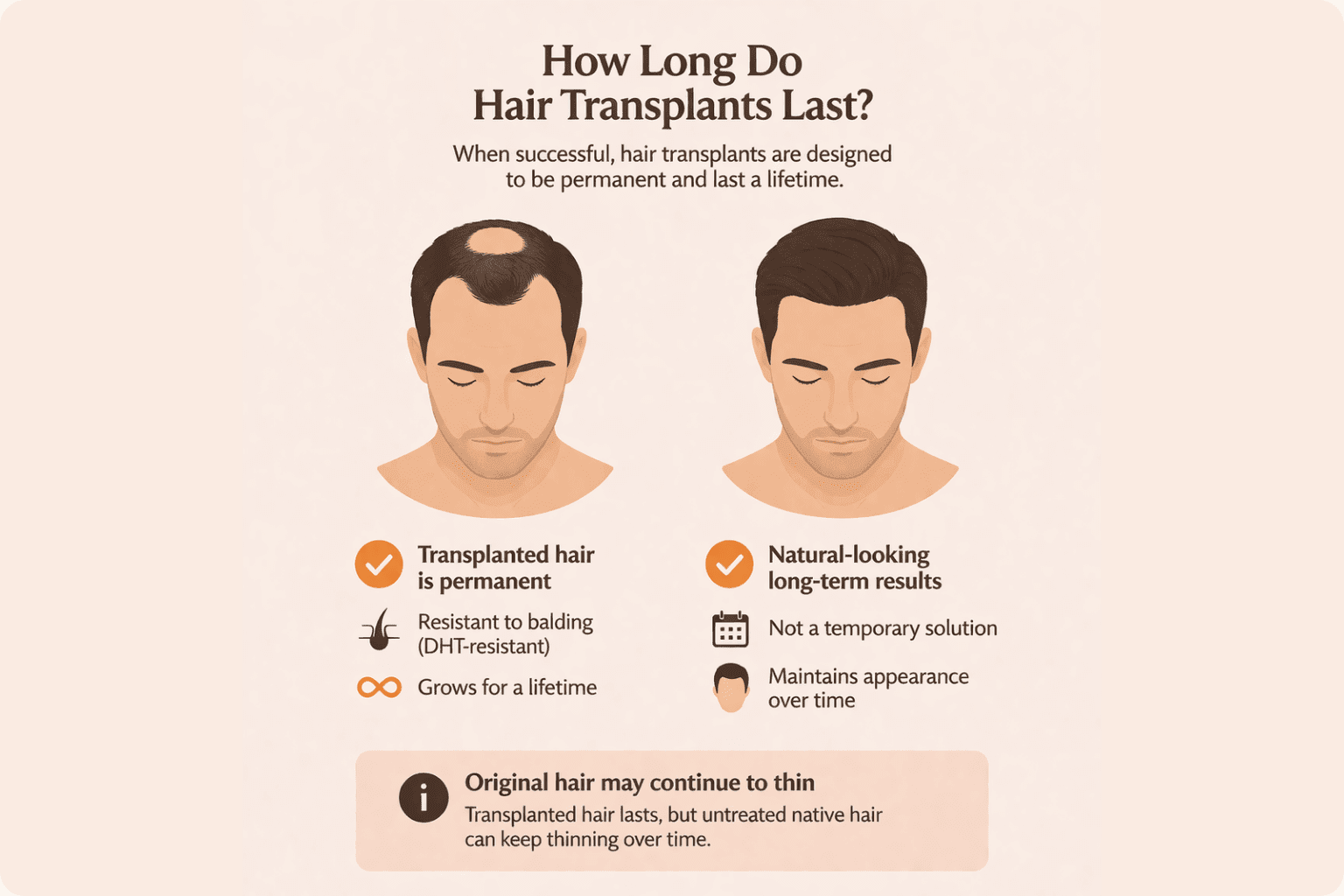 how long does a hair transplant last