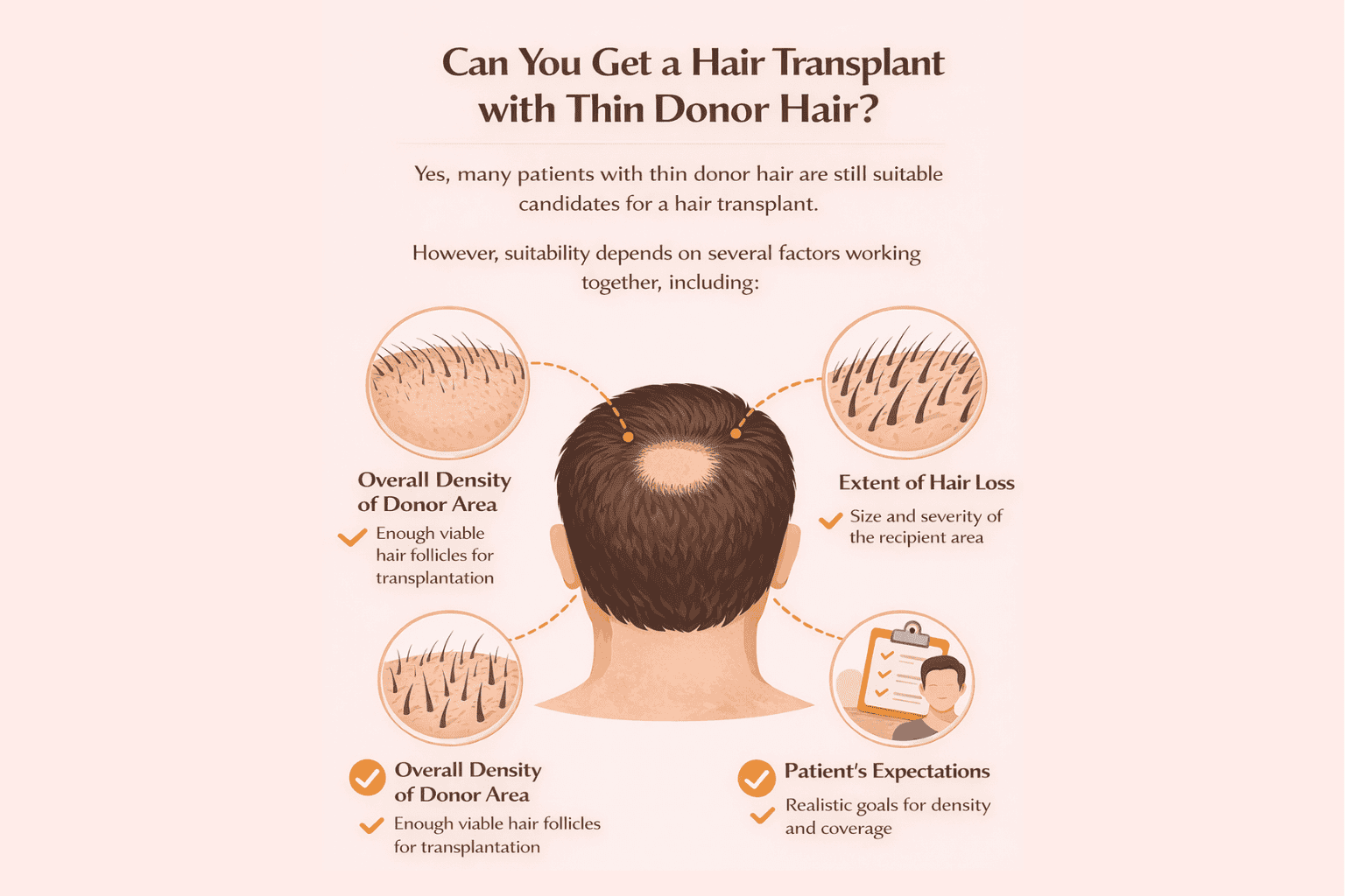 what is thin donor hair?