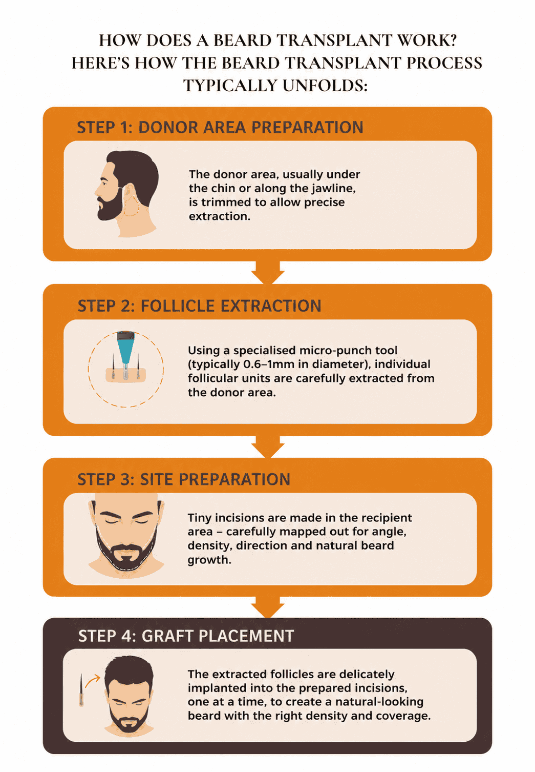 beard transplant how does it work?